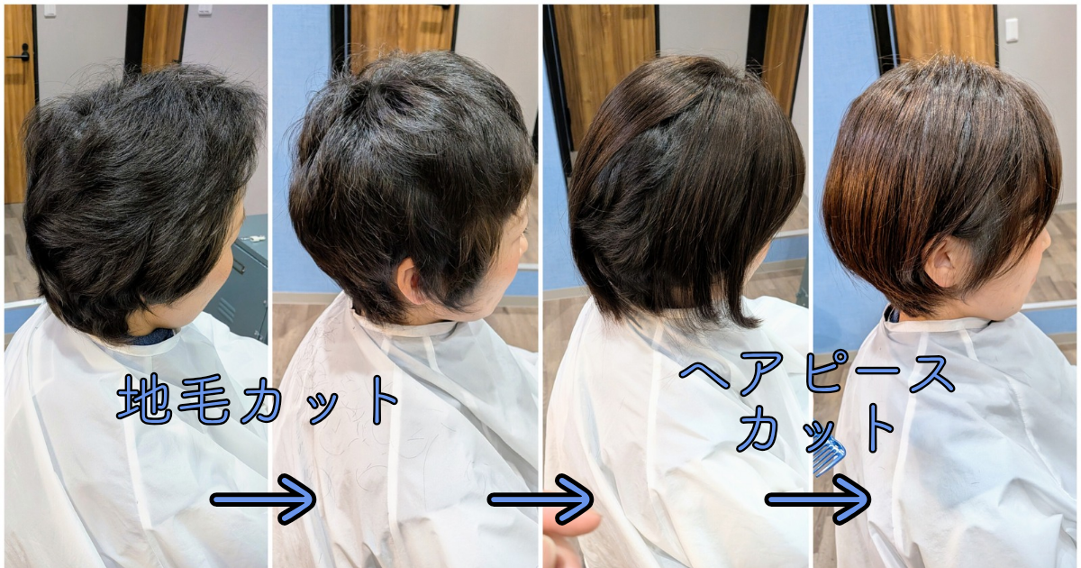 抗がん剤治療後8カ月－地毛とヘアピースを馴染ませ理想のショートへ 